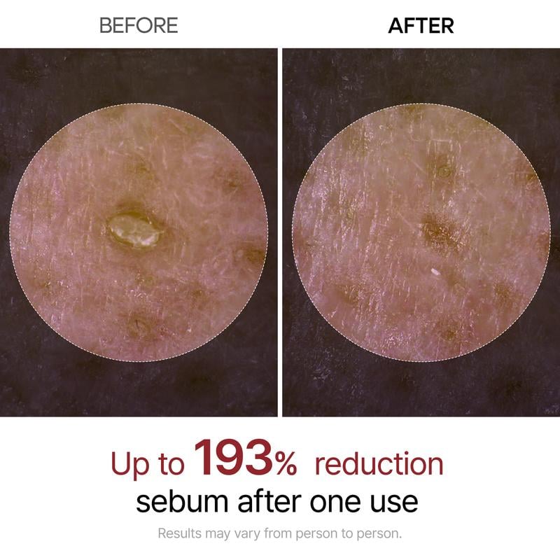 🏆Flash Sale⚡ 50K+ SOLD! Almost Gone-💥🔥Peel Shot Glow Rice Ampoule Duo